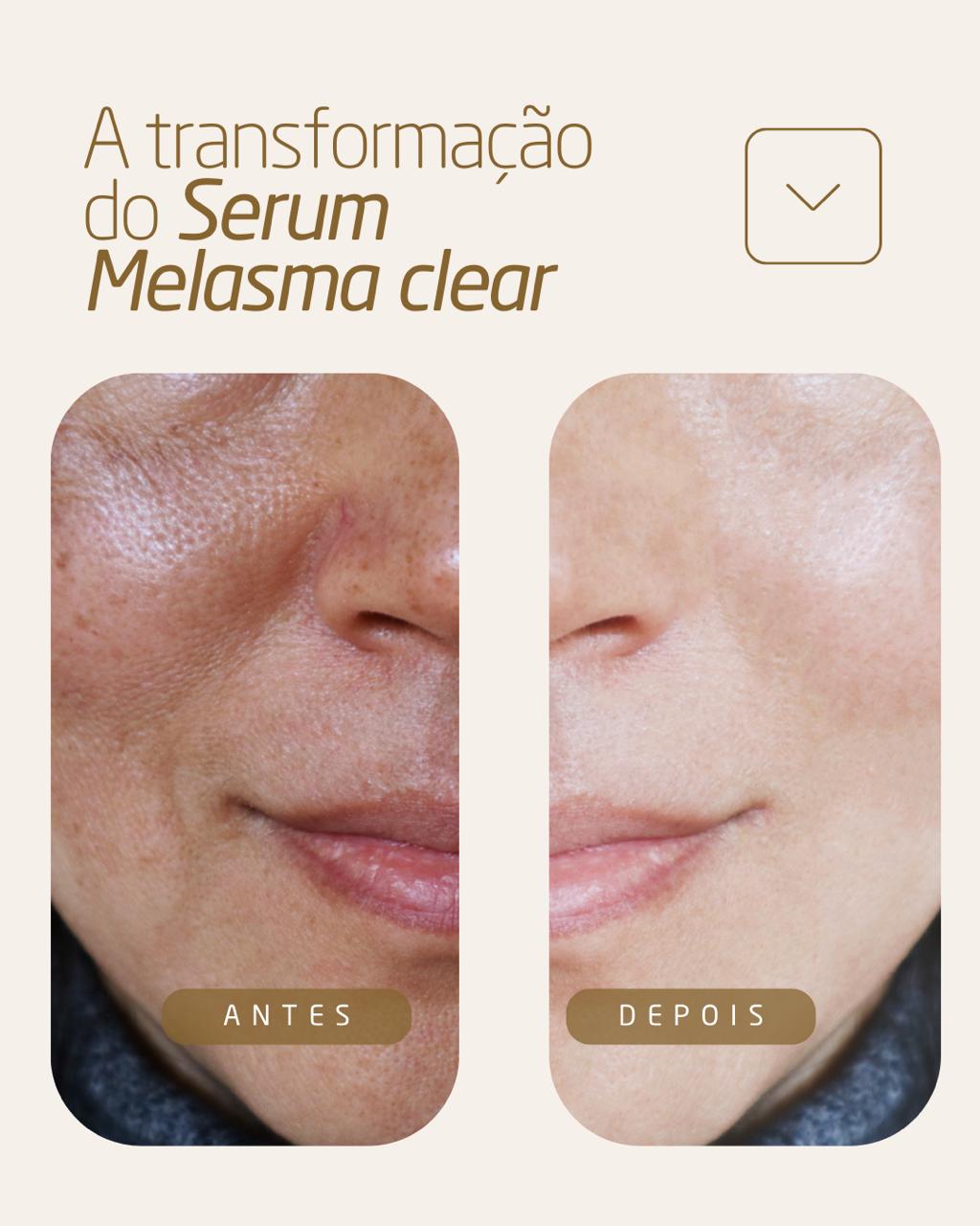 S&eacute;rum Melasma Clear - Dermachem - Bem Mulher Maquiagem